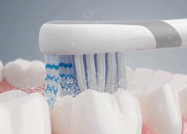 電動牙刷刷牙好嗎？真的比手動牙刷更好嗎？